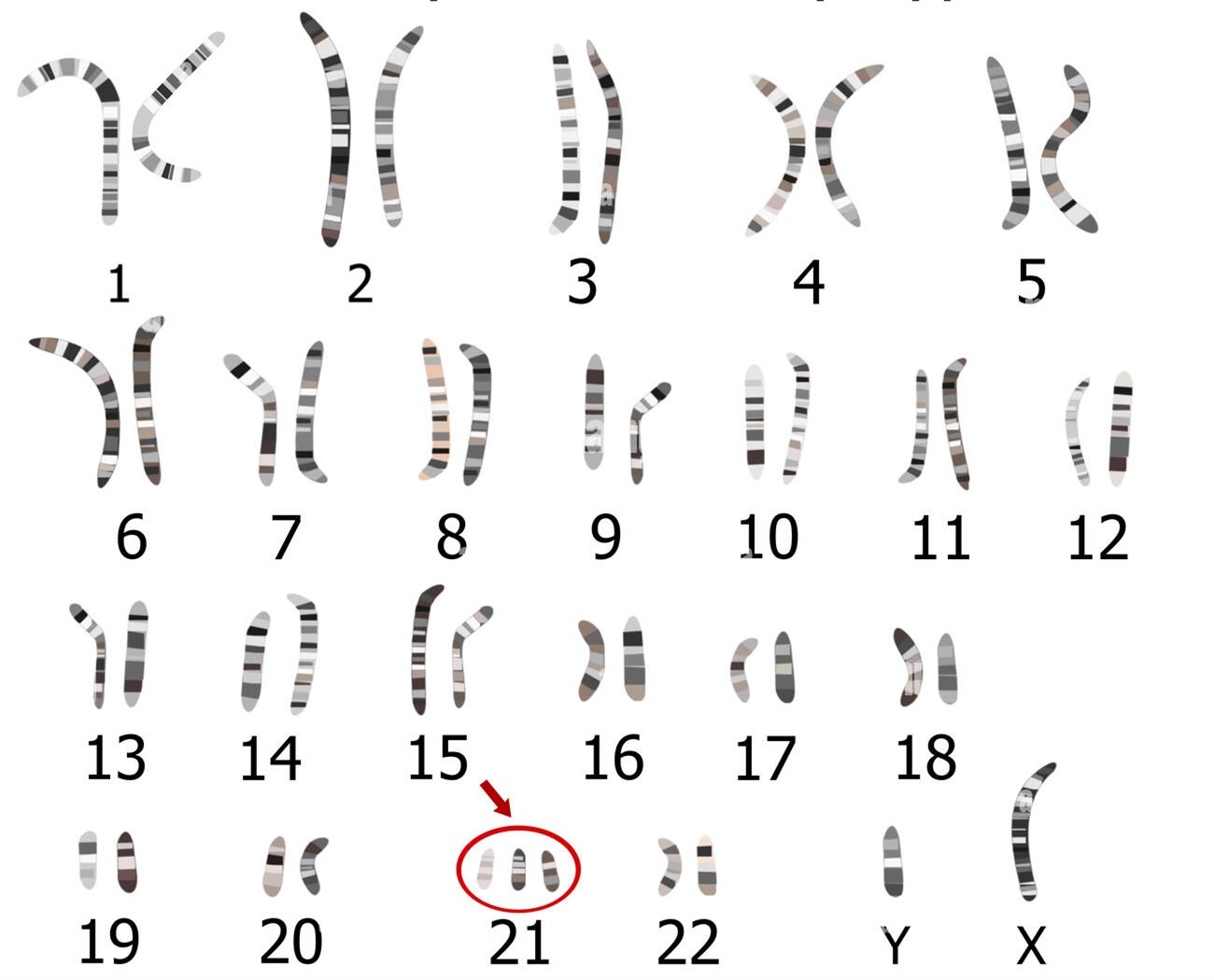 caryotype